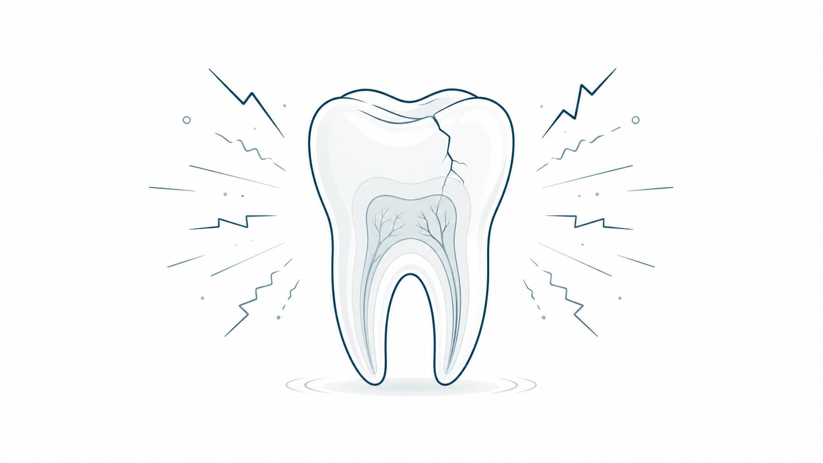 Dolor dental persistente antes de una endodoncia